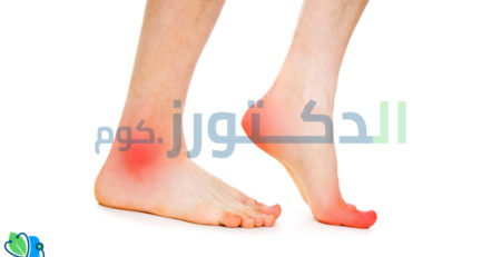علاج-تورم-أصابع-القدم-بسبب-الحذاء
